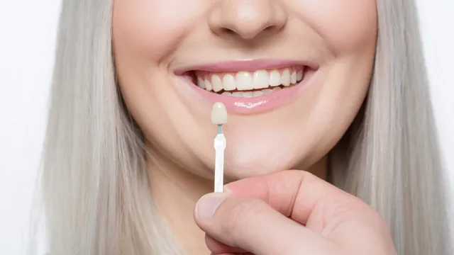 Kings Crown Dentistry - 22