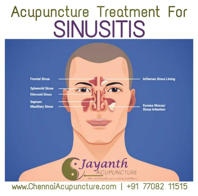 Jayanth Acupuncture Clinic - Anna Nagar - 2