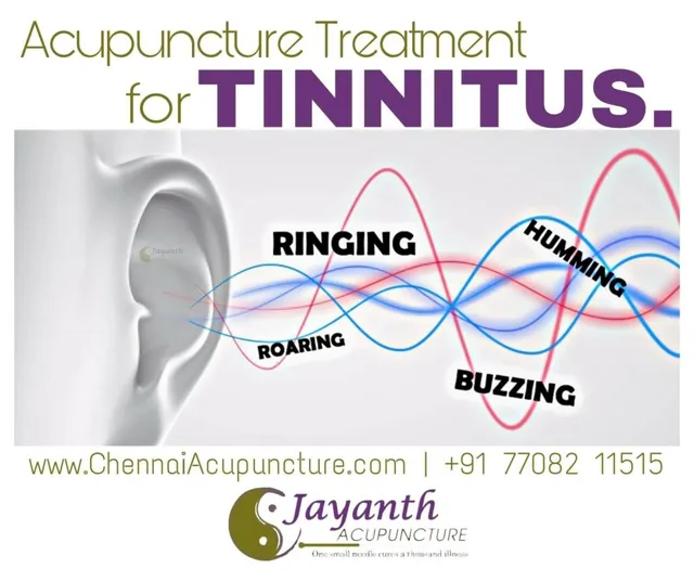 Jayanth Acupuncture Clinic - Anna Nagar - 9