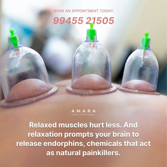 Amara Hijama / Cupping Therapy Mangalore - 9