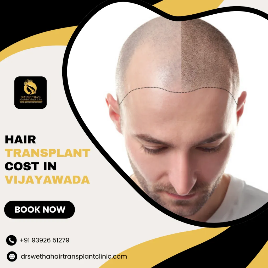 Dr.Swetha's Hair & Skin Clinic-Best Hair Loss Doctors in Vijayawada