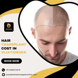 Dr.Swetha's Hair & Skin Clinic-Best Hair Loss Doctors in Vijayawada