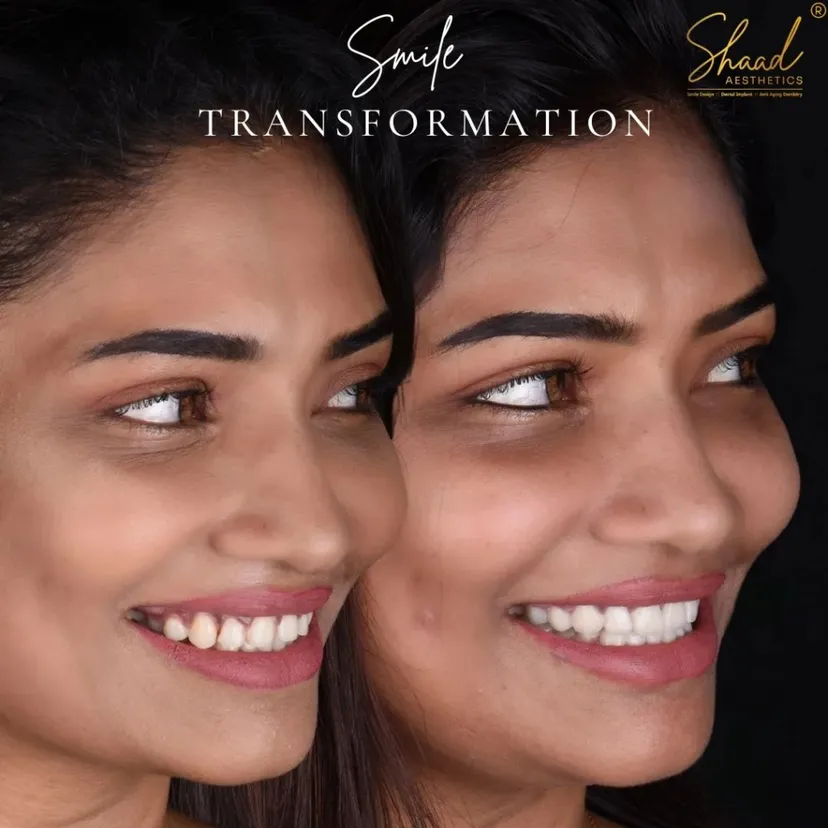 Shaad Aesthetics cosmetic dental clinic in Coimbatore