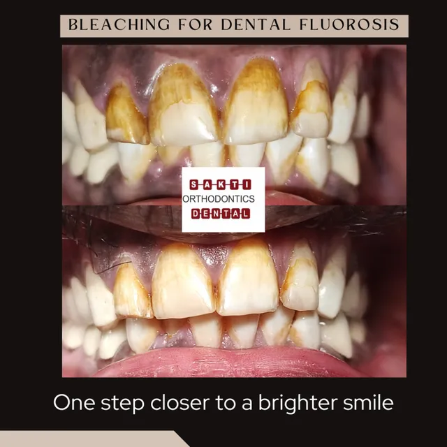 Best Dental Clinic in Tirunelveli | Sakti Dental & Orthodontic Clinic - 4