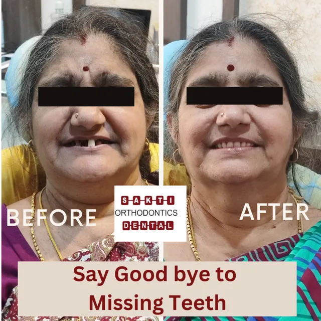 Best Dental Clinic in Tirunelveli | Sakti Dental & Orthodontic Clinic - 6