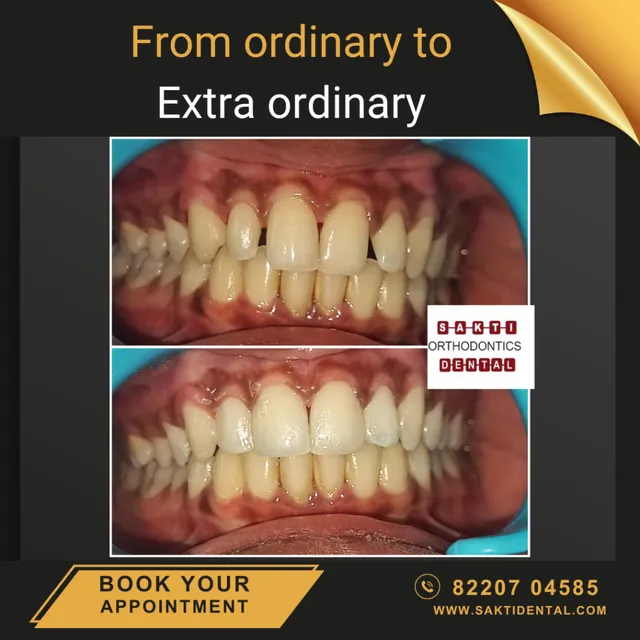 Best Dental Clinic in Tirunelveli | Sakti Dental & Orthodontic Clinic - 8