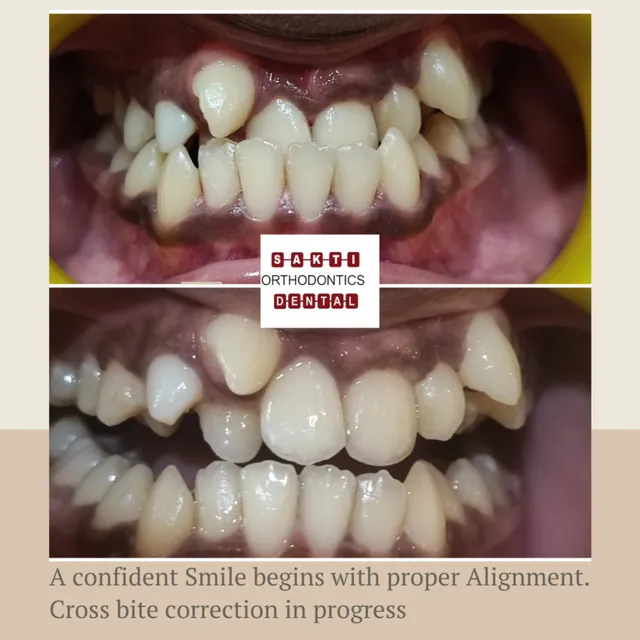 Best Dental Clinic in Tirunelveli | Sakti Dental & Orthodontic Clinic - 9