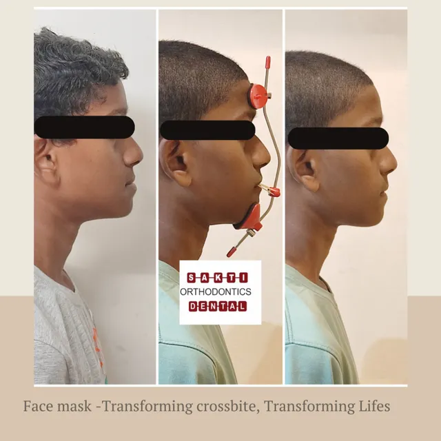 Best Dental Clinic in Tirunelveli | Sakti Dental & Orthodontic Clinic - 10