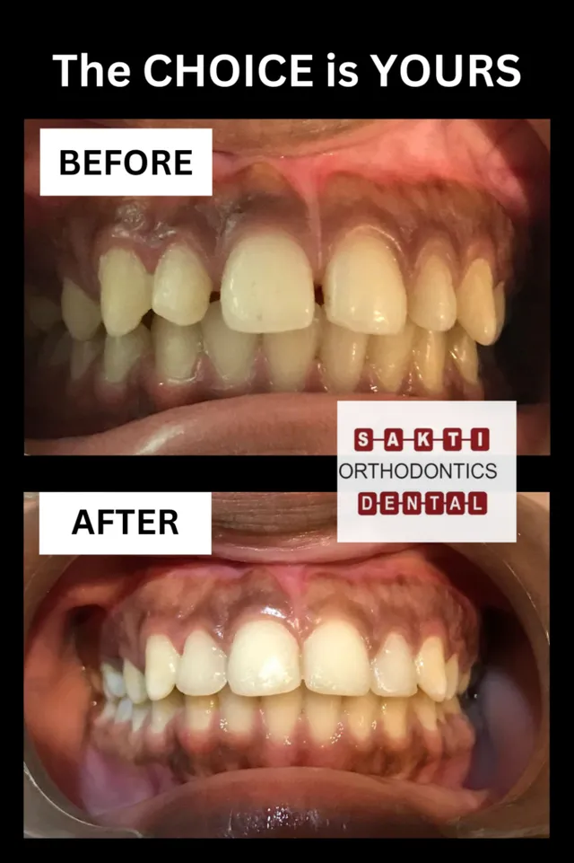 Best Dental Clinic in Tirunelveli | Sakti Dental & Orthodontic Clinic - 11