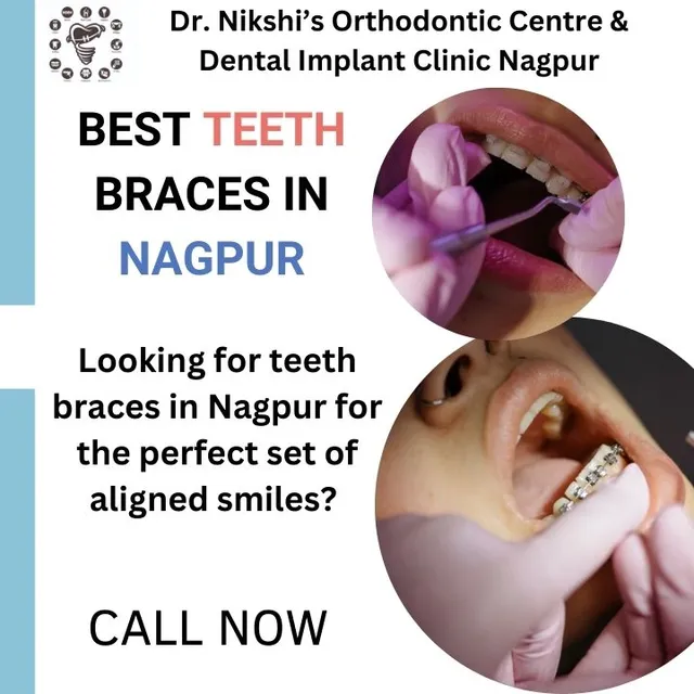 Dr. Nikshi’s Orthodontic Centre &amp; Dental Implant Clinic Nagpur - 5