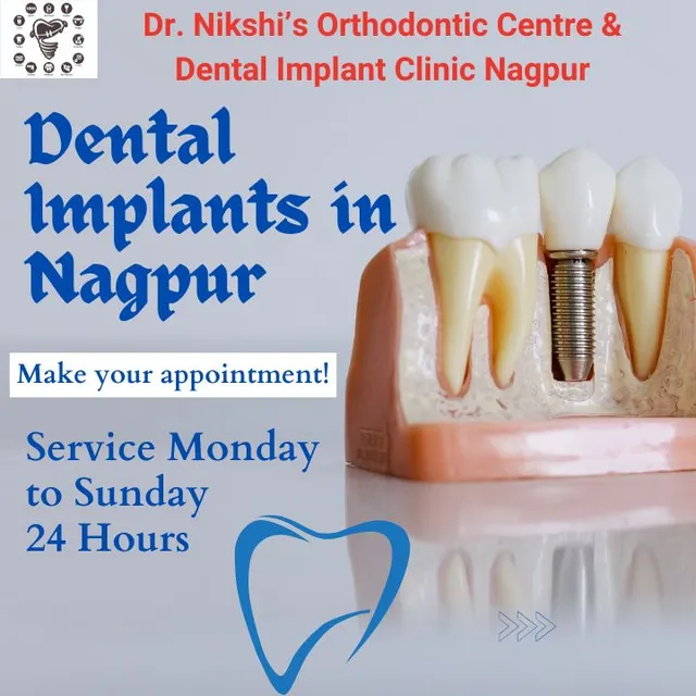 Dr. Nikshi’s Orthodontic Centre &amp; Dental Implant Clinic Nagpur - 7