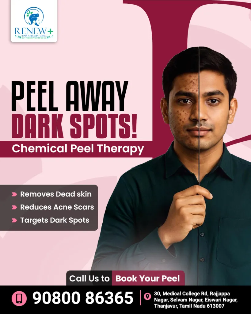 Renew Plus Hair and Skin Clinic - Thanjavur
