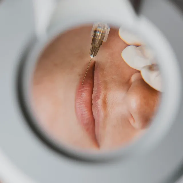 Renew Plus Hair and Skin Clinic - Thanjavur - 10