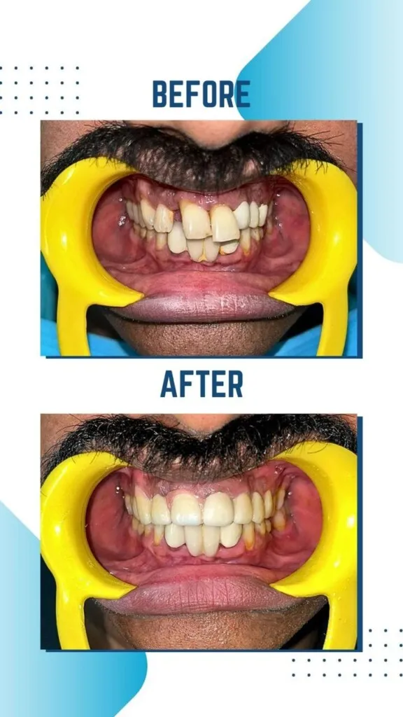 SYC DENTAL By Dr. Riya Soni