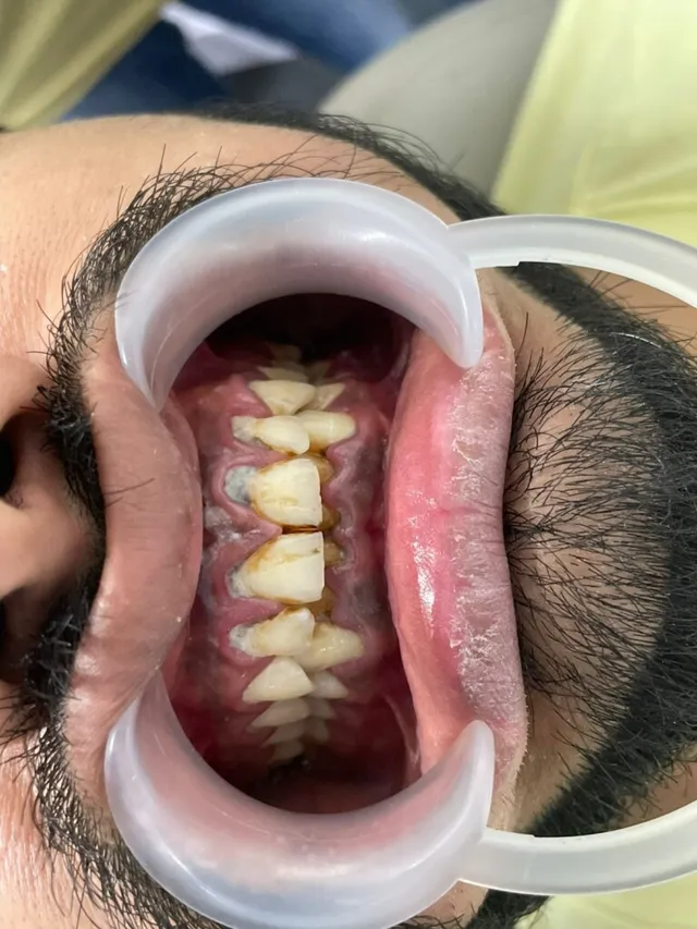 SYC DENTAL By Dr. Riya Soni - 5