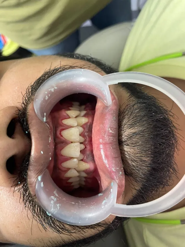 SYC DENTAL By Dr. Riya Soni - 6