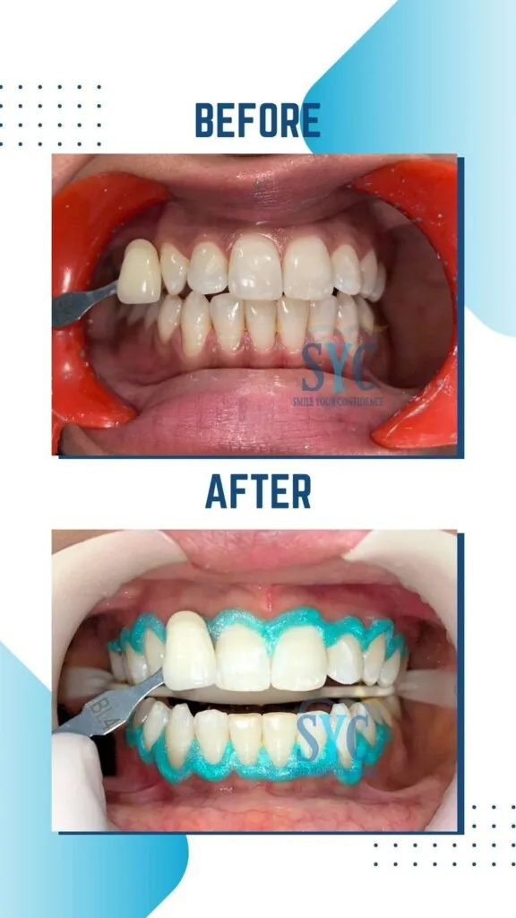 SYC DENTAL By Dr. Riya Soni - 2