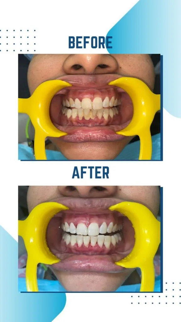 SYC DENTAL By Dr. Riya Soni - 3