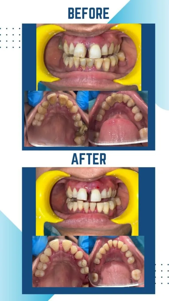 SYC DENTAL By Dr. Riya Soni - 4