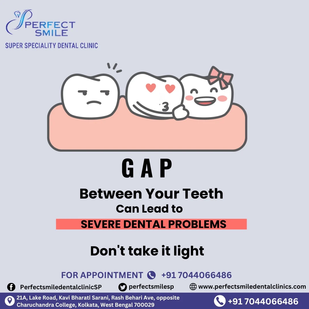 Perfect Smile Super Speciality Dental Clinic Kolkata - Best Dental Clinic in Kolkata