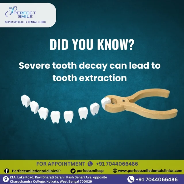 Perfect Smile Super Speciality Dental Clinic Kolkata - Best Dental Clinic in Kolkata - 3