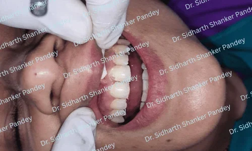 Pandey Dental Clinic - 2