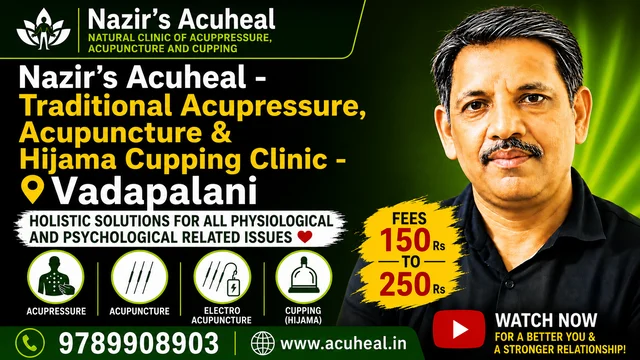 Nazir’s Acuheal - Traditional Acupuncture & Hijama Cupping Clinic - 3