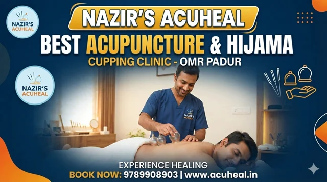 Nazir’s Acuheal - Traditional Acupuncture & Hijama Cupping Clinic - 4