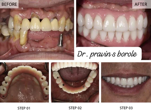 Anand Dental clinic & implant center - 3