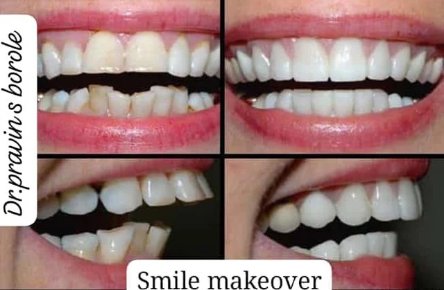 Anand Dental clinic & implant center - 4